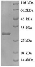 Recombinant Escherichia coli NAD (P)H-flavin reductase (fre) – Figure 1 of 1