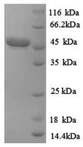 Recombinant Corynebacterium efficiens Uncharacterized protein – Figure 1 of 1