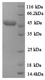 Recombinant Corynebacterium efficiens Uncharacterized protein – Figure 1 of 1