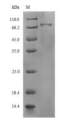 Recombinant Influenza A virus Hemagglutinin (HA), partial – Figure 1 of 1