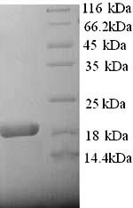 Recombinant Rat Alpha-2-macroglobulin (A2m), partial – Figure 1 of 1