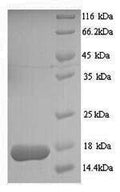 Recombinant Entamoeba histolytica Multidrug resistance protein 1 (MDR1) – Figure 1 of 1