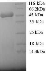 Recombinant Human 3-ketoacyl-CoA thiolase, mitochondrial (ACAA2) – Figure 1 of 1