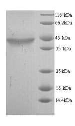 Recombinant Human Alcohol dehydrogenase class-3 (ADH5) – Figure 1 of 1