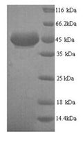 Recombinant Human All-trans-retinol dehydrogenase [NAD (+)] ADH7 (ADH7) – Figure 1 of 1