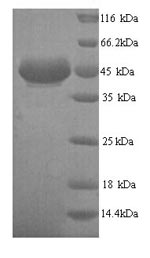 Recombinant Human All-trans-retinol dehydrogenase [NAD (+)] ADH7 (ADH7) – Figure 1 of 1