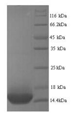Recombinant Human Beta-1 adrenergic receptor (ADRB1), partial – Figure 1 of 1