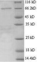 Recombinant Mouse Alpha-fetoprotein (Afp) – Figure 1 of 1