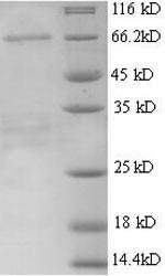 Recombinant Mouse Alpha-fetoprotein (Afp) – Figure 1 of 1