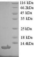 Recombinant Human Type-1 angiotensin II receptor (AGTR1), partial – Figure 1 of 1
