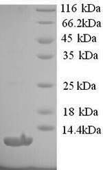 Recombinant Human Type-1 angiotensin II receptor (AGTR1), partial – Figure 1 of 1