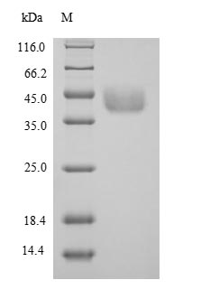 Recombinant Mouse Serine--pyruvate aminotransferase, mitochondrial (Agxt) – Figure 1 of 1