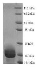 Recombinant Rat Allograft inflammatory factor 1 (Aif1) – Figure 1 of 1