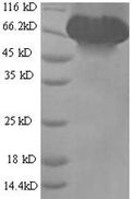 Recombinant Dog Albumin (ALB) – Figure 1 of 1