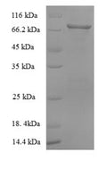Recombinant Macaca fascicularis albumin (ALB) – Figure 1 of 1