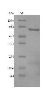 (Tris-Glycine gel) Discontinuous SDS-PAGE (reduced) with 5% enrichment gel and 15% separation gel.