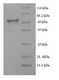 Recombinant Human Succinate-semialdehyde dehydrogenase, mitochondrial (ALDH5A1) – Figure 1 of 1