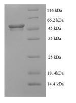 Recombinant Human Succinate-semialdehyde dehydrogenase, mitochondrial (ALDH5A1) – Figure 1 of 1