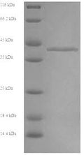 Recombinant Rabbit Fructose-bisphosphate aldolase B (ALDOB) – Figure 1 of 1