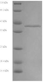 Recombinant Rabbit Fructose-bisphosphate aldolase B (ALDOB) – Figure 1 of 1