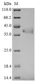 (Tris-Glycine gel) Discontinuous SDS-PAGE (reduced) with 5% enrichment gel and 15% separation gel.