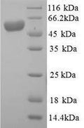 Recombinant Human Intestinal-type alkaline phosphatase (ALPI) – Figure 1 of 1