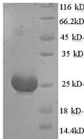 Recombinant Mouse Muellerian-inhibiting factor (Amh), partial – Figure 1 of 1