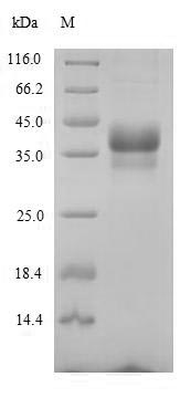 (Tris-Glycine gel) Discontinuous SDS-PAGE (reduced) with 5% enrichment gel and 15% separation gel.