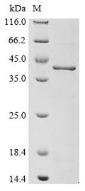 (Tris-Glycine gel) Discontinuous SDS-PAGE (reduced) with 5% enrichment gel and 15% separation gel.