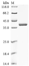 (Tris-Glycine gel) Discontinuous SDS-PAGE (reduced) with 5% enrichment gel and 15% separation gel.
