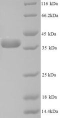 (Tris-Glycine gel) Discontinuous SDS-PAGE (reduced) with 5% enrichment gel and 15% separation gel.