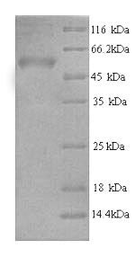 Recombinant Human AP-2 complex subunit mu (AP2M1) – Figure 1 of 1