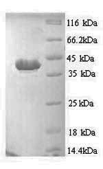 Recombinant Human Apoptotic protease-activating factor 1 (APAF1), partial – Figure 1 of 1