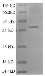 Recombinant Human DNA- (apurinic or apyrimidinic site) lyase (APEX1) – Figure 1 of 1
