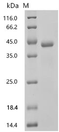 (Tris-Glycine gel) Discontinuous SDS-PAGE (reduced) with 5% enrichment gel and 15% separation gel.
