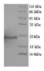 Recombinant Human Aquaporin-4 (AQP4), partial – Figure 1 of 1