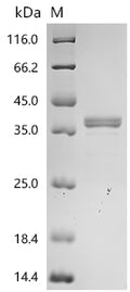 (Tris-Glycine gel) Discontinuous SDS-PAGE (reduced) with 5% enrichment gel and 15% separation gel.