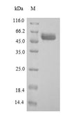 Recombinant Human Arylsulfatase B (ARSB) – Figure 1 of 1