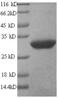 Recombinant Human GPI-linked NAD (P) (+)--arginine ADP-ribosyltransferase 1 (ART1) – Figure 1 of 1