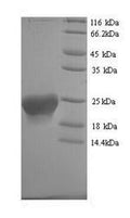 Recombinant Human Putative inactive neutral ceramidase B (ASAH2B) – Figure 1 of 1