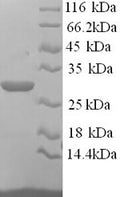 Recombinant Mouse Asialoglycoprotein receptor 1 (Asgr1), partial – Figure 1 of 1