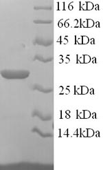 Recombinant Mouse Asialoglycoprotein receptor 1 (Asgr1), partial – Figure 1 of 1