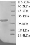 Recombinant Human Potassium-transporting ATPase subunit beta (ATP4B), partial – Figure 1 of 1