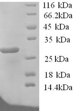 Recombinant Human Potassium-transporting ATPase subunit beta (ATP4B), partial – Figure 1 of 1