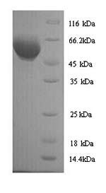 Recombinant Mouse ATP synthase subunit beta, mitochondrial (Atp5b) – Figure 1 of 1