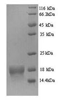 Recombinant Human ATP synthase subunit delta, mitochondrial (ATP5D) – Figure 1 of 1