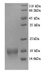 Recombinant Human ATP synthase subunit delta, mitochondrial (ATP5D) – Figure 1 of 1