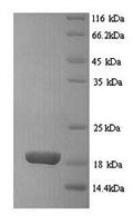 Recombinant Rat Basic leucine zipper transcriptional factor ATF-like 3 (Batf3) – Figure 1 of 1
