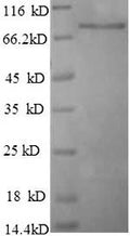 Recombinant Human Breast carcinoma-amplified sequence 1 (BCAS1) – Figure 1 of 1