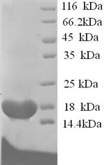 Recombinant Dog Cholinesterase (BCHE) – Figure 1 of 1